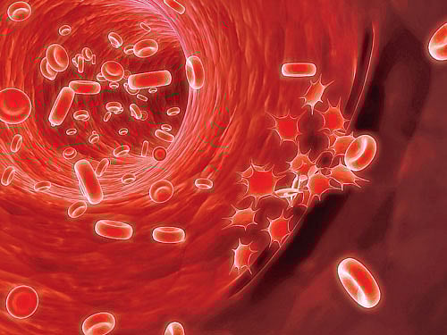 If proper care is not taken, the danger of contracting a more virulent form of the disease called the Dengue Hemorrhagic Fever (DHF) gets real.