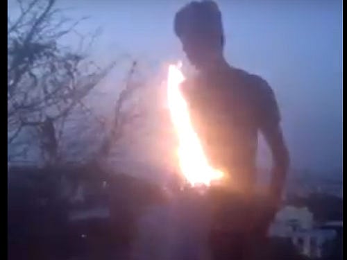 The boy, a resident of Barkas in Old City here, succumbed to serious burn injuries yesterday at a hospital, they said.