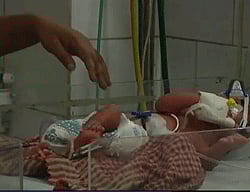 The State of World's Children, UNICEF's flagship annual report, which was released on Tuesday, revealed that in 2030, 17% of under-five deaths in the world will be in India. Reuters file image for represnetation.