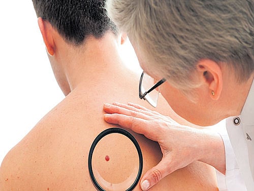 Don't ignore that mole