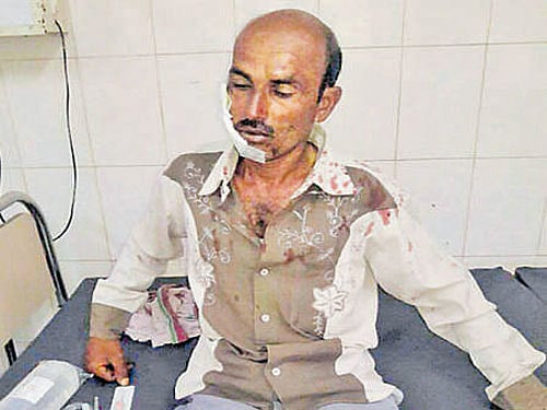 An injured being treated at a hospital on Monday night. PTI