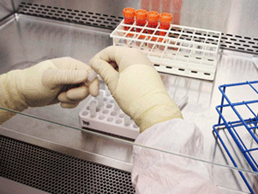 Researchers at the Hokkaido University in Japan, inoculated human bladder cancer cells labelled with luciferase into mice, creating a xenograft bladder cancer model. Reuters file photo for representational purpose only