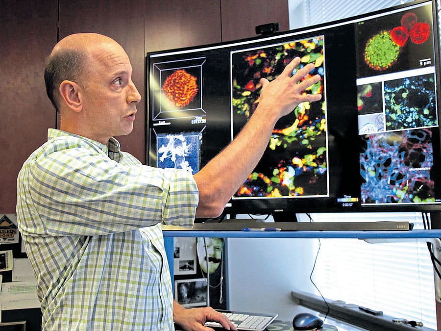 MatthewKrummel, a researcher at the University of California, looks at immune cells in his lab. Immunotherapy, hyped as god's gift in treating cancer, poses potential danger for the patient. Researchers say they need more time to tameit. NYT