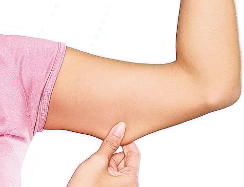 Fat cells called adipocytes are normally found in the skin, but they are lost when wounds heal as scars. The most common cells found in healing wounds are myofibroblasts, which were thought to only form a scar. File photo. For representation purpose