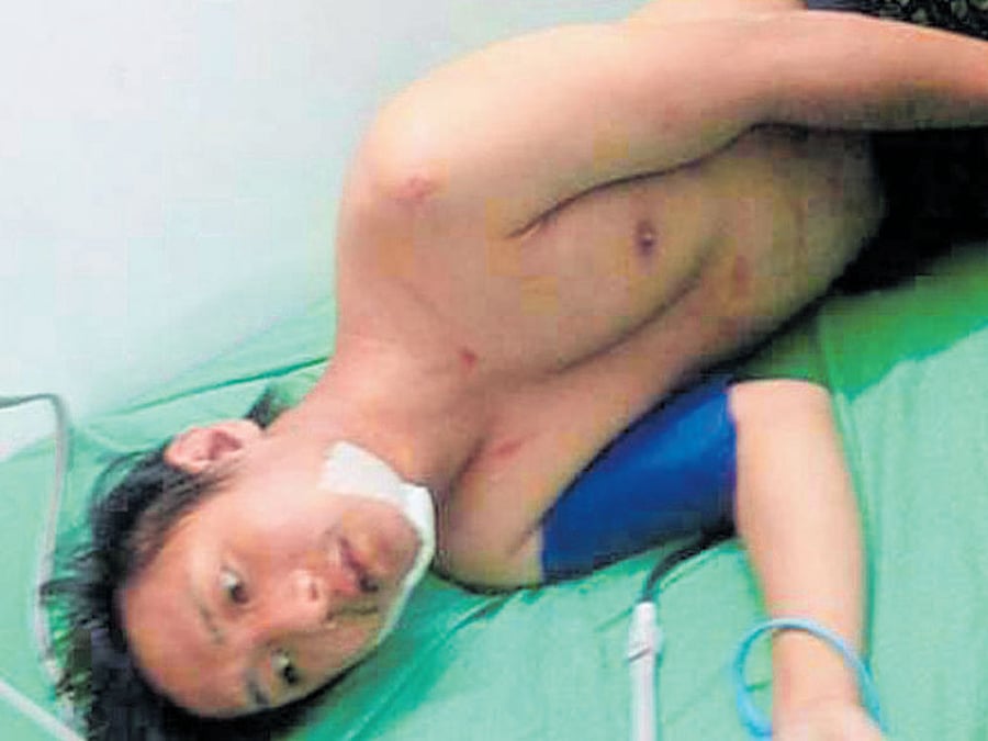 Higio Gungtey, a youth from the Northeast who was made to lick his landlord's shoe, another incident of assault on a Northeastern man has come to light in Mico Layout.