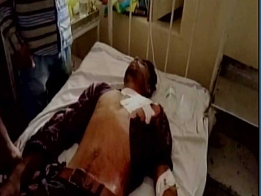 Violence broke out today during a farmers' protest in Mandsaur in Madhya Pradesh following which curfew was today clamped in Pipalya Mandi area and prohibitory orders imposed in other parts of the district, officials said. Picture courtesy ANI