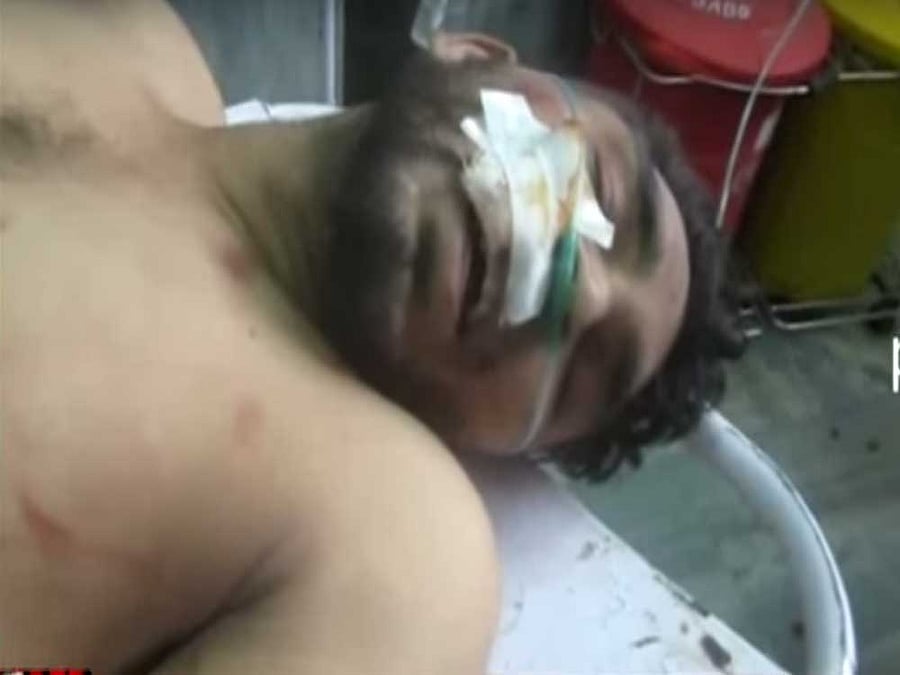 Vinod, whose hand and foot were chopped off, was shifted to the Civil hospital at Talwandi Sabo. Screen Grab