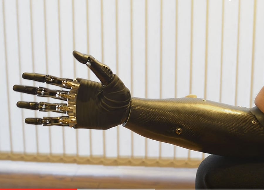 The approach will allow prosthetics to be more natural in their functioning thanks to improved performance. photo for representation.