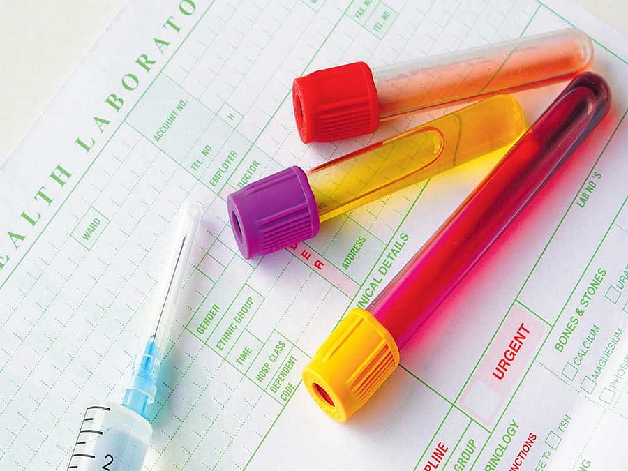 The device can help cut down the time taken for cancer diagonses, potentially aiding chances in combating the disease. Representative image.