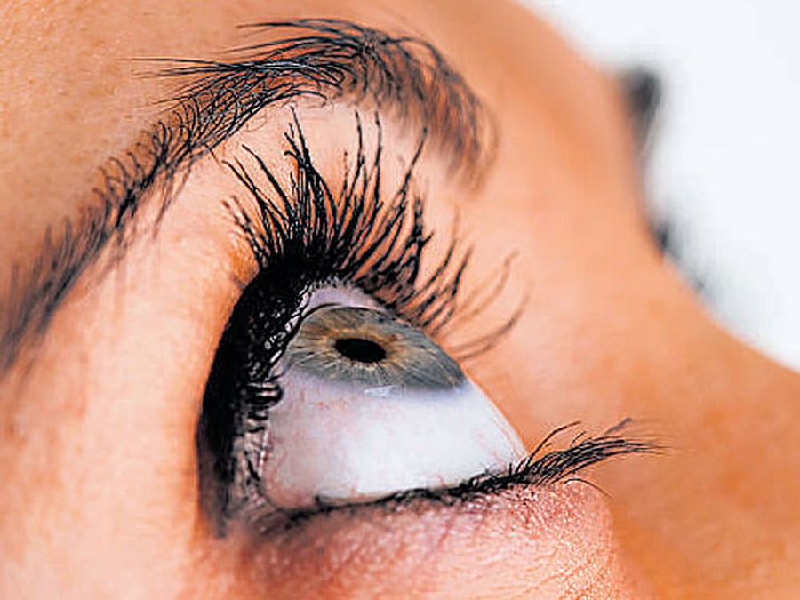 They also showed improvement in light sensitivity and peripheral vision, which are two visual deficits these patients experience. Representational Image