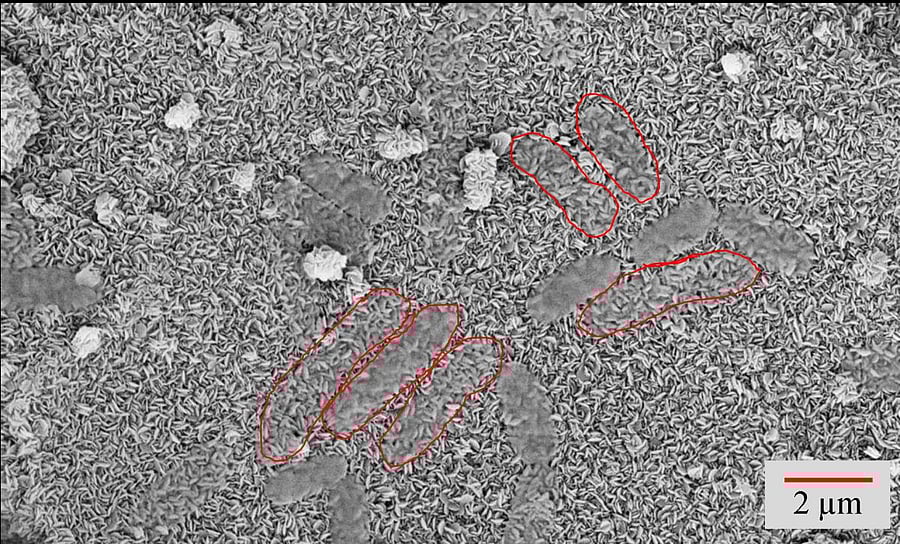 Dead and dying bacteria on etched aluminium surface; these surfaces can be used in common areas of hospitals to prevent infections.