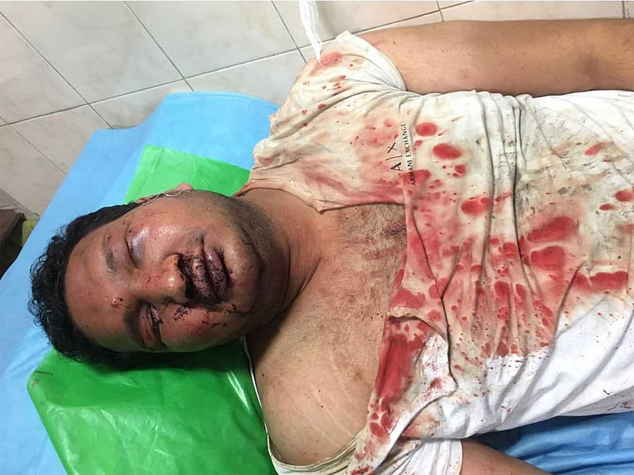 The friends of the victim, Vidwath L, had beaten up one of the suspects, Arun Babu. This clearly shows that it was a group clash, the counsel submitted.