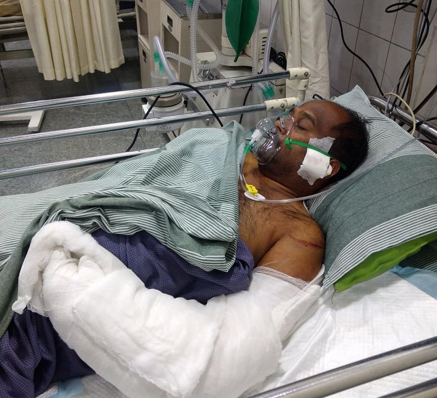 Ravi Kumar , 35 years taking treatement at Hosmat hospital in Bengaluru.