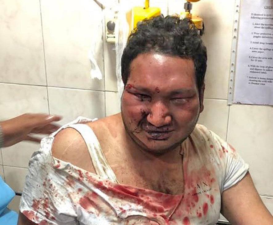 The Special Public Prosecutor (SPP) in the pub brawl case submitted before the sessions court that no one came to Vidwath's rescue as Mohammed Nalapad Haris had created an atmosphere of terror among the public in the central business district. DH photo