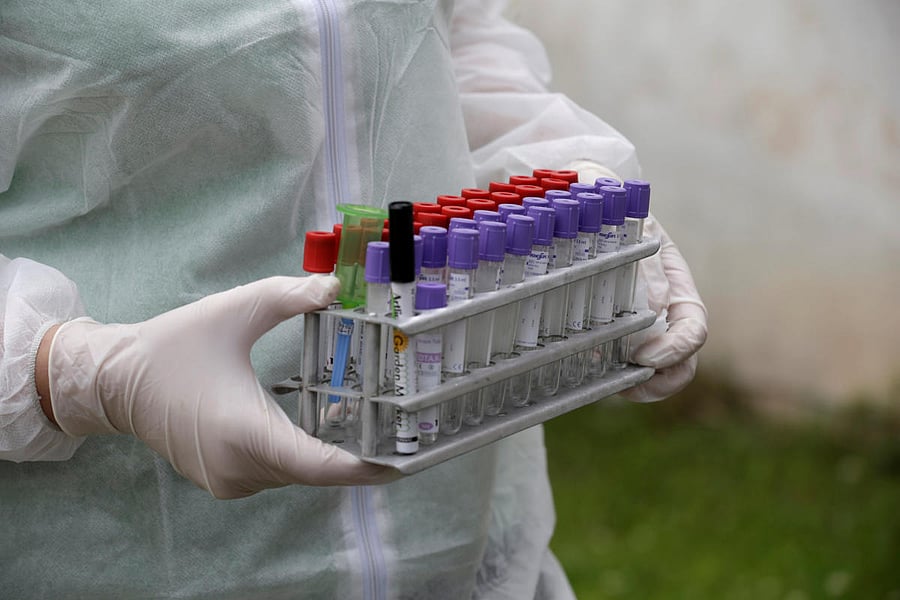 There would also be tests for thalassemia beta, Tay Sachs Disease and a type of Parkinson's Disease