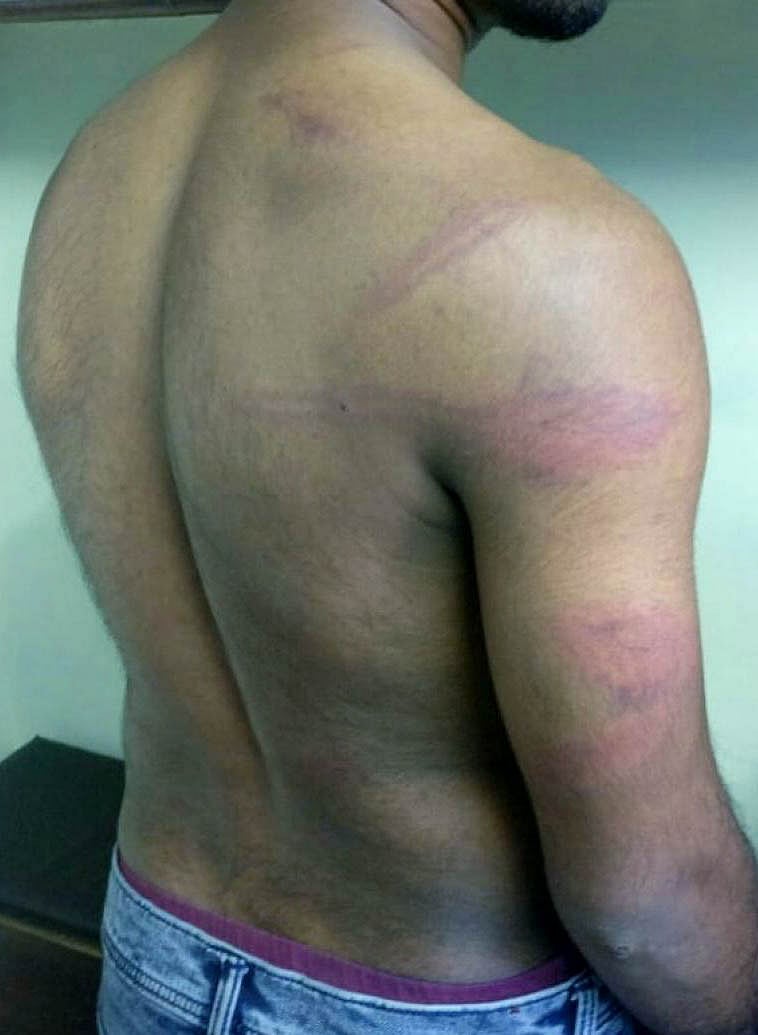 The Banaswadi police allegedly assaulted a man for having his hands tucked in his pocket at Janakiram Layout on July 28. Sathish (in pic), a resident of Lingarajapuram and his son Samson, say they were beaten up when he tried to reason out with the police.