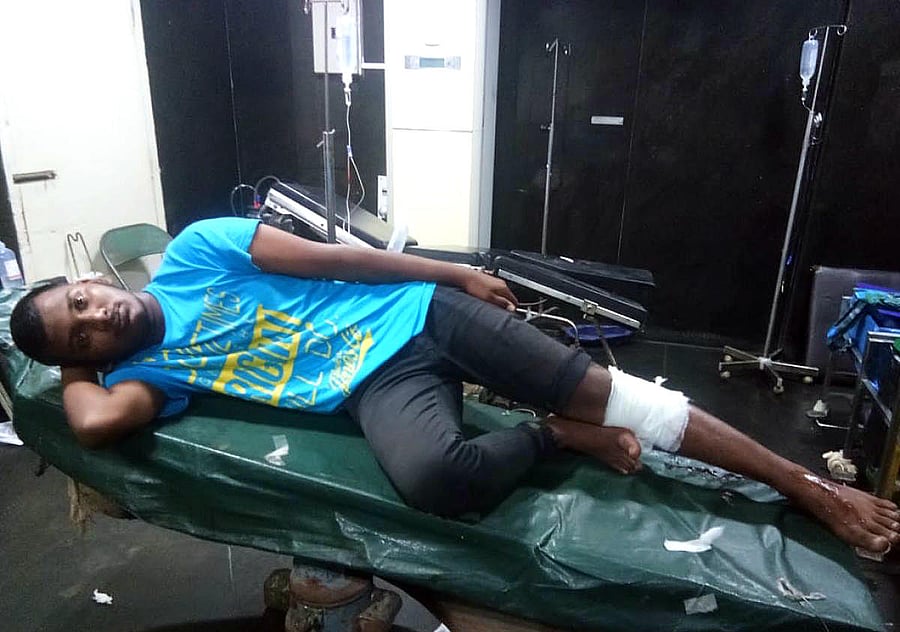 Abhishek, 19, who was fired upon and caught in Hennur Bande on Monday night. 