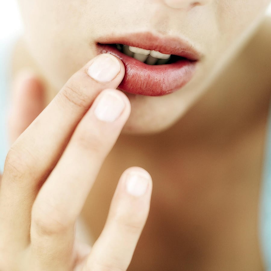 Dry lips are common in winter. Using emollients can resolve it.