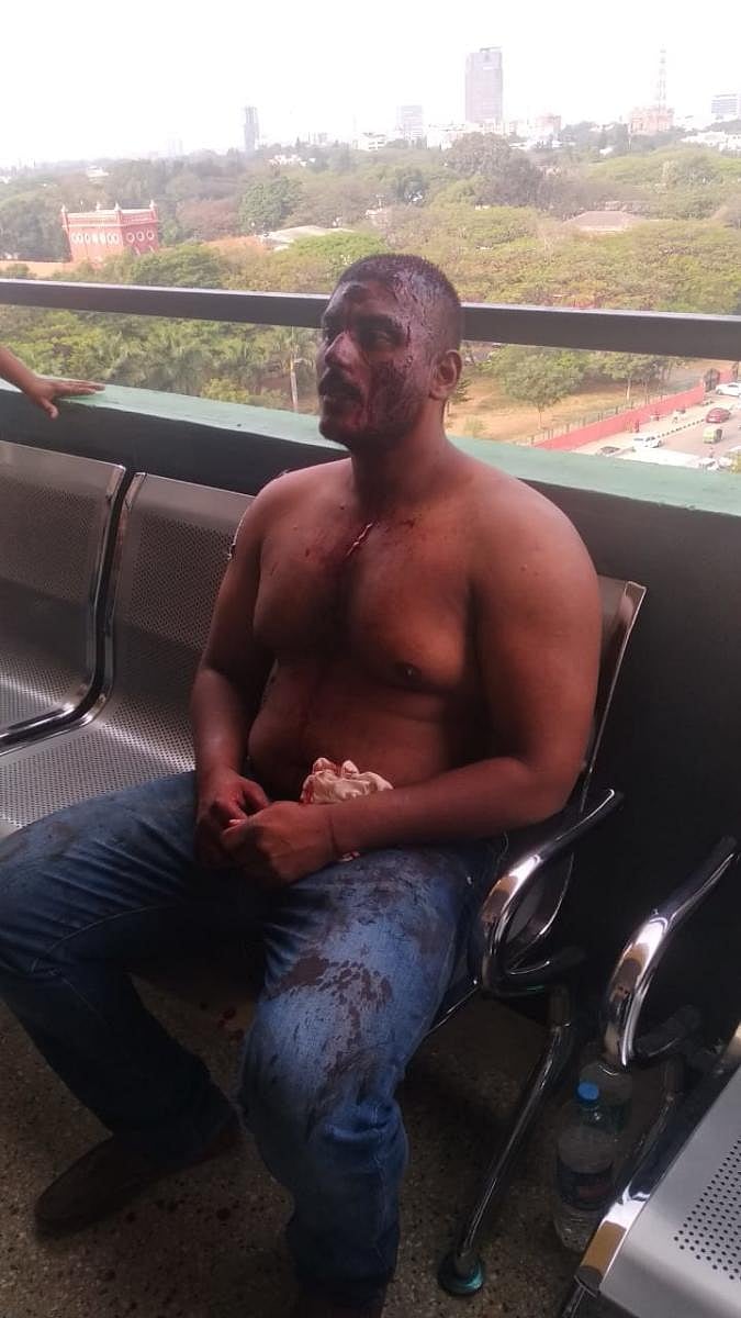 Anil, who was accompanying the accused in advocate Dharani suicide case, was reportedly assaulted by a group of advocates at the City Civil Court Complex in Bengaluru on Monday. 