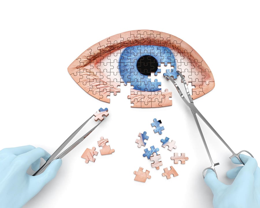 cataract