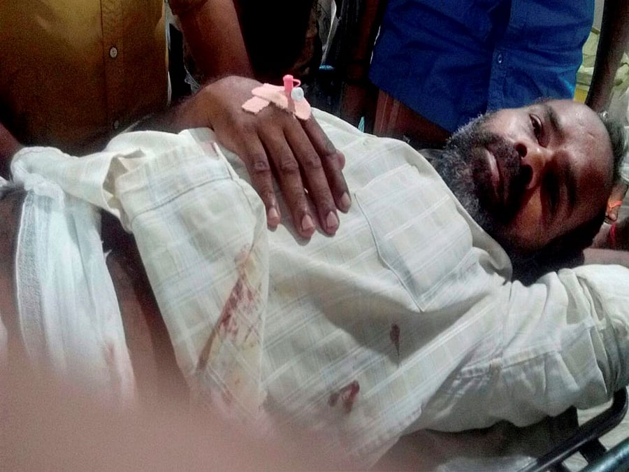 BJP activist TP Babu, who was injured in a bomb attack at RSS office at Nadapuram being treated at a hospital in Kozhikode on Thursday night. PTI photo