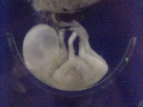 The recent study by the premier medical institution also suggested that nearly 35 per cent of the cases in these 17 years were stillborn, 29 per cent were born alive and 36 per cent were born before the period of viability. File Photo.