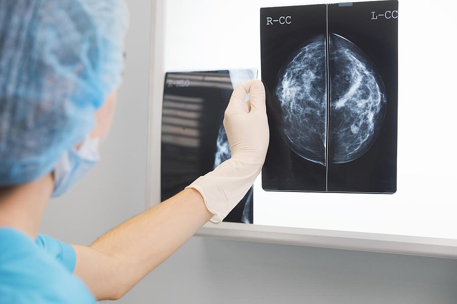 There are more than 20,000 X-ray centers in Karnataka.