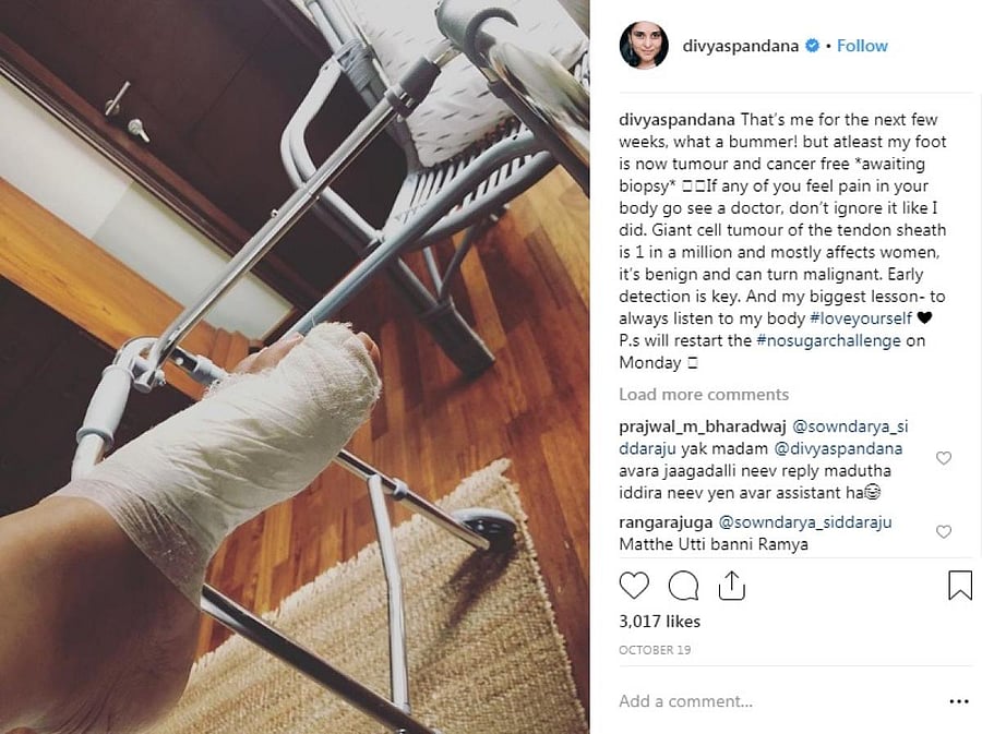 Actress Ramya aka Divyaspandana posted the picture of her injured leg on Instagram.