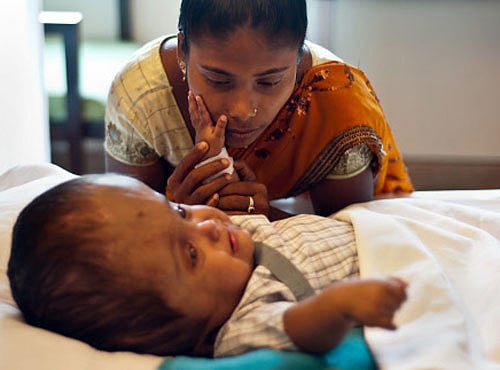 Baby Roona's head size further reduced, set to go home