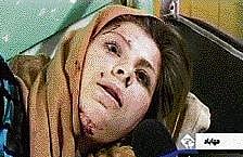 A TV grab shows a wounded Iranian woman speaking to a journalist after a bomb blast in Mahabad on Wednesday. AP