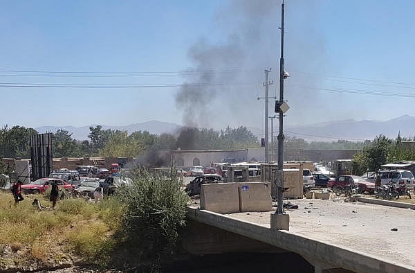 Representative image.