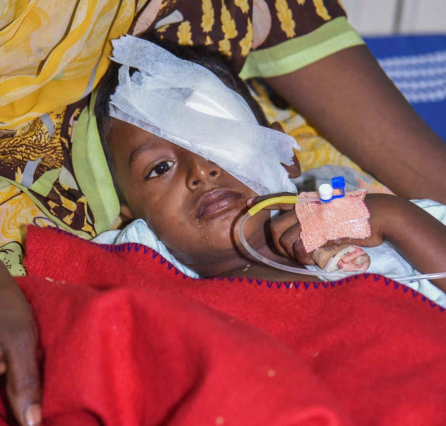 Venkatesh, who was injured while lighting a cracker. DH Photo/S K Dinesh