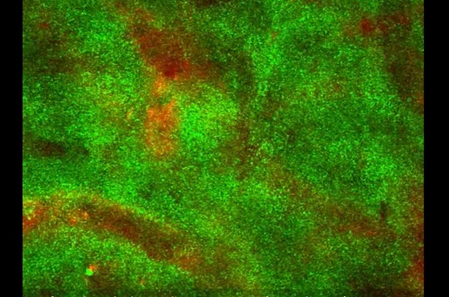 Photo: Yale University/YouTube