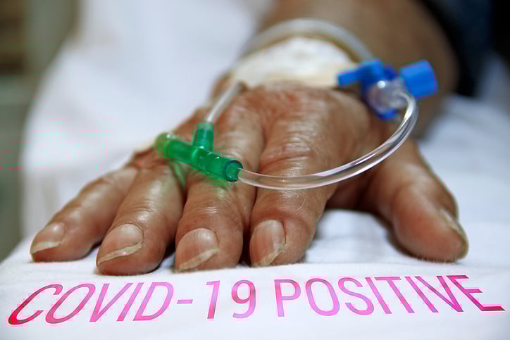 Coronavirus covid-19 infected patient's hand (Image for representation/iStock Photo)