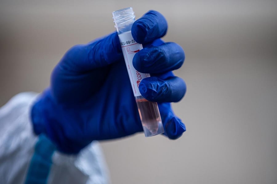 Test tube for the COVID-19 (AFP Photo)