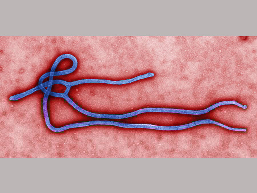 The virus that constitutes Ebola can persist in survivors for more than 2 years post-infection through their semen. CDC file photo.