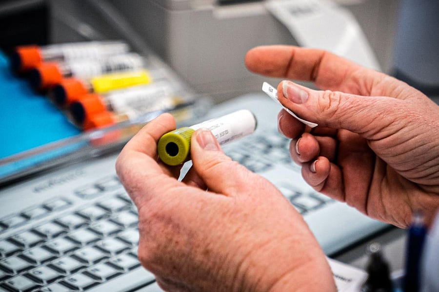 An employee of a medical laboratory registrates a sample of the novel coronavirus COVID-19. (AFP Photo)