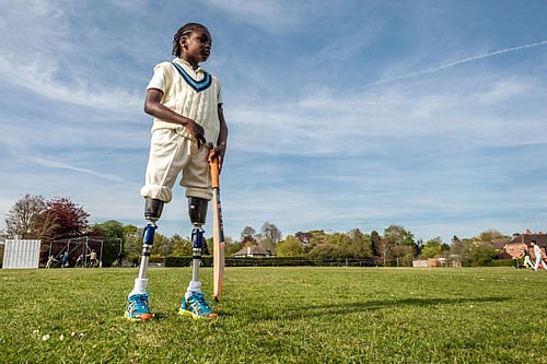 Harvey Parry, whose both legs were amputated when he was just 15-months-old, just loves playing cricket. Screen grab