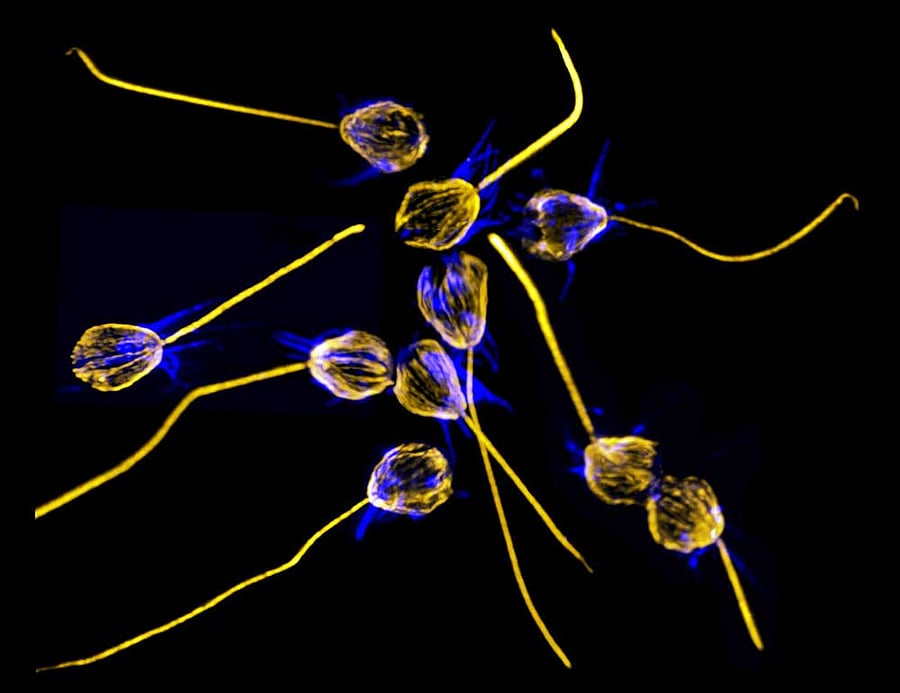 Controlling hand: Choanoflagellate S rosetta swarms and mates in response to a protein secreted by V fischeribacteria. Photo credit: Arielle Woznica