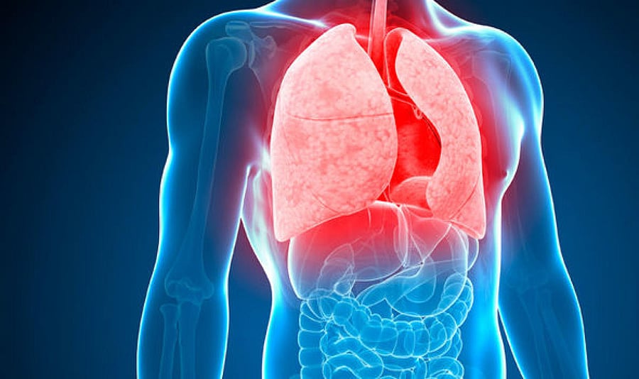 Health researchers say the findings are of public health concern because India has the world's highest burden of TB.