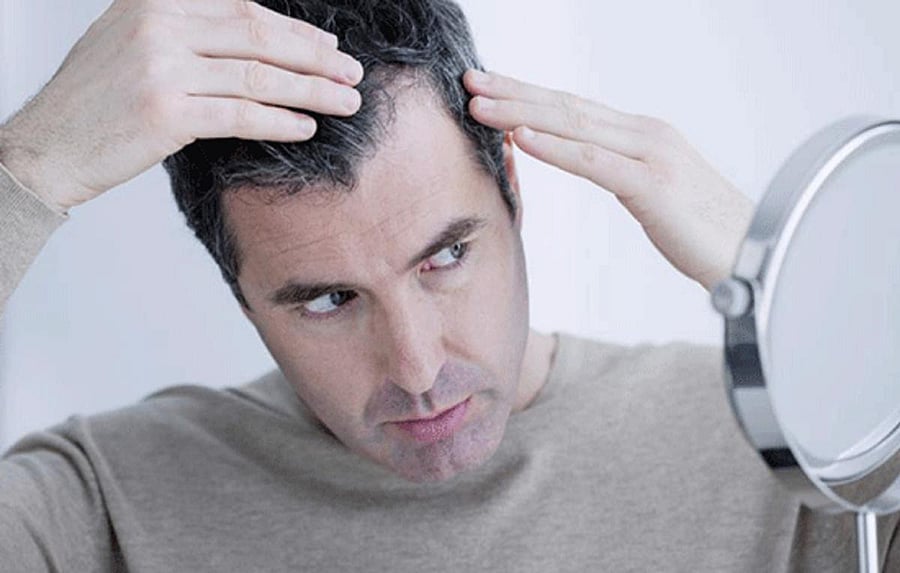 The common reason for premature greying in both men and women is hormonal issues.