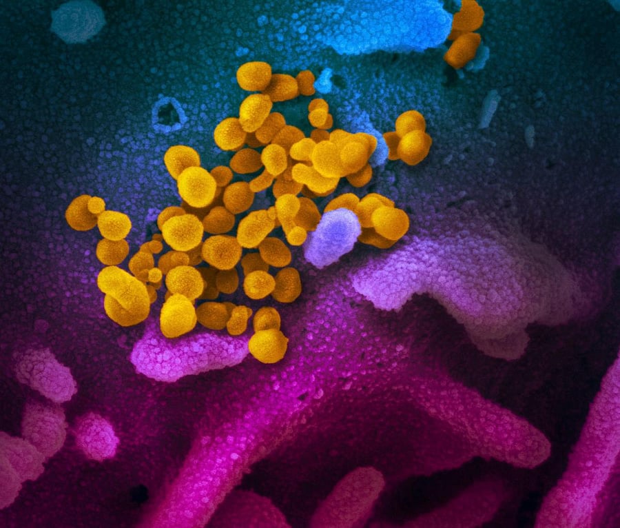 National Institutes of Health taken with a scanning electron microscope shows SARS-CoV-2 (yellow)—also known as 2019 nCoV or COVID-19. (AFP Photo)