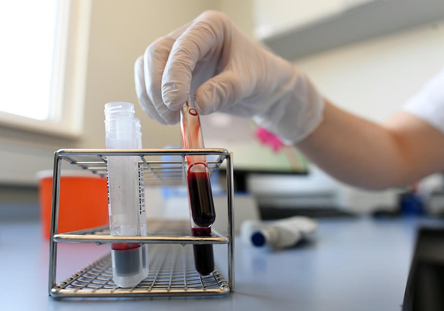 Sonja Krauthoefer of the University Hospital Erlangen checks donated blood and plasma samples, if the blood of the donor can be used for the production of therapeutic plasma for the treatment of seriously ill patients of COVID-19 (Reuters Photo)