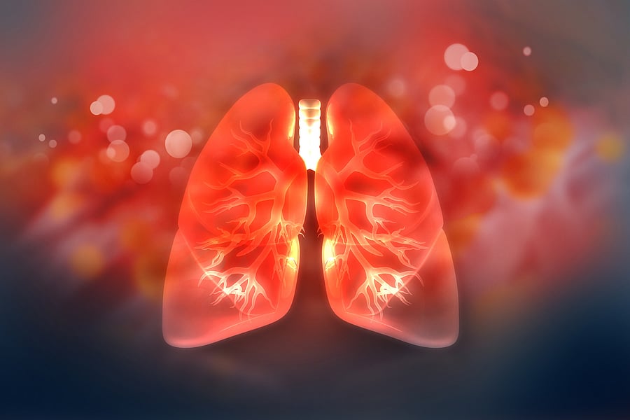 Representative image. Credit: iStock