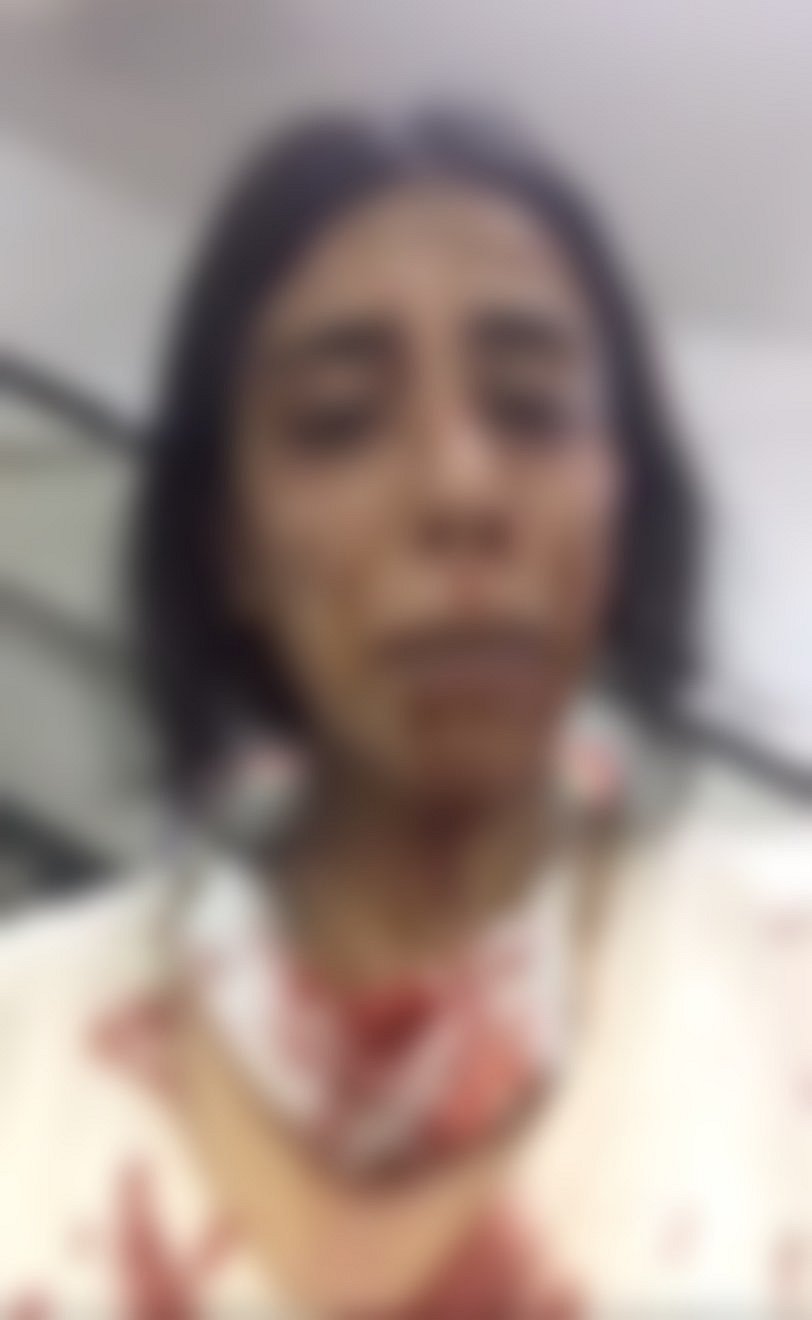 Five Army personnel were killed and another was seriously injured on Thursday after their vehicle caught fire in a terrorist attack.