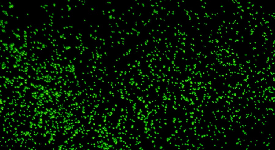 Microbes revived from 101.5 million-year-old sediment cores gathered from deep beneath the seafloor under the Pacific Ocean. Credit: Reuters Photo
