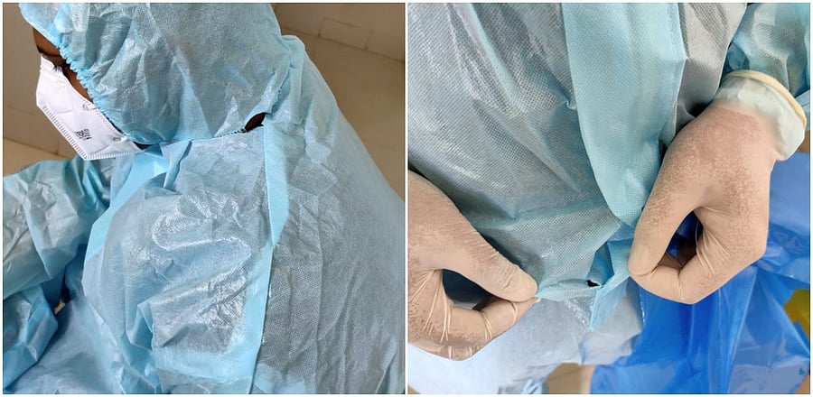 The photographic evidence provided by the student union members of the KIMS shows PPE kits being torn at multiple places.