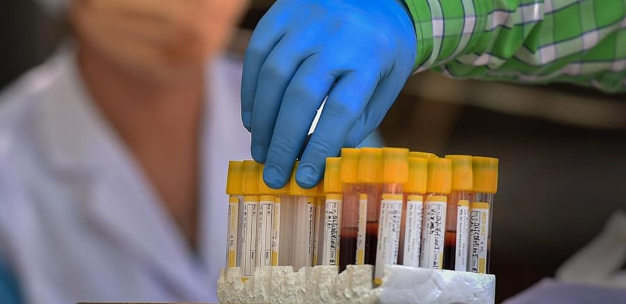 A health worker handles a vial containing blood sample of a person for serological survey, at a school in New Delhi, Thursday, Aug 6, 2020. Credit: PTI Photo