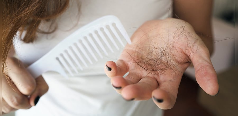 Now, doctors say, many patients recovering from Covid-19 are experiencing hair loss — not from the virus itself but from the physiological stress of fighting it off. Credit: iStock Photo