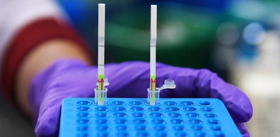 West Bengal has tested 44,127 samples for Covid-19 in the last 24 hours. Credit: AFP